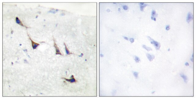 Anti-Syntaxin 1A, N-Terminal antibody produced in rabbit affinity isolated antibody