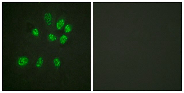 Anti-Estrogen Receptor-&#946; antibody produced in rabbit affinity isolated antibody