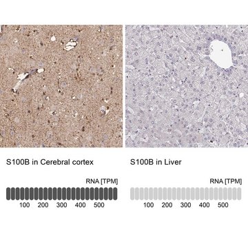 Anti-S100B antibody produced in rabbit affinity isolated antibody, buffered aqueous glycerol solution