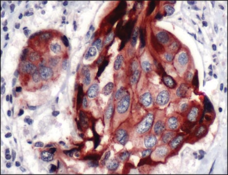 Anti-E-Cadherin antibody, Rabbit monoclonal recombinant, expressed in proprietary host, clone SP64, affinity isolated antibody