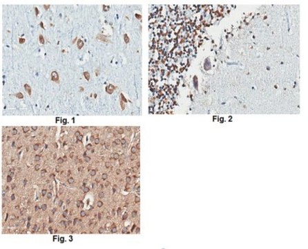 Anti-PKC&#950; Antibody, clone 14B12.3 clone 4B12.3, from mouse