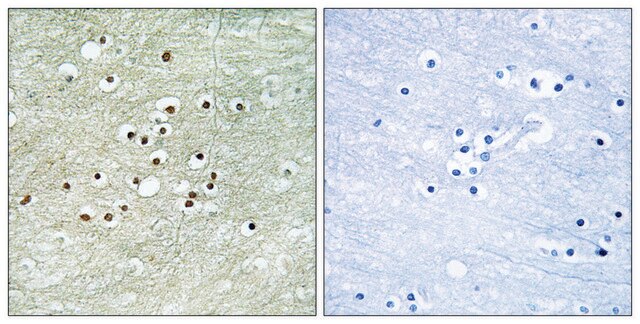 Anti-NPAS4 antibody produced in rabbit affinity isolated antibody