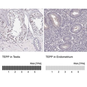 Anti-TEPP antibody produced in rabbit Prestige Antibodies&#174; Powered by Atlas Antibodies, affinity isolated antibody