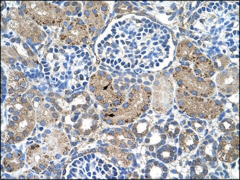 Anti-GLS2 IgG fraction of antiserum