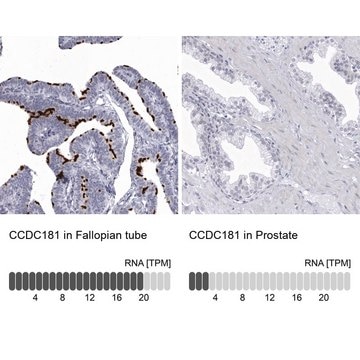 Anti-CCDC181 antibody produced in rabbit Prestige Antibodies&#174; Powered by Atlas Antibodies, affinity isolated antibody, buffered aqueous glycerol solution, ab3