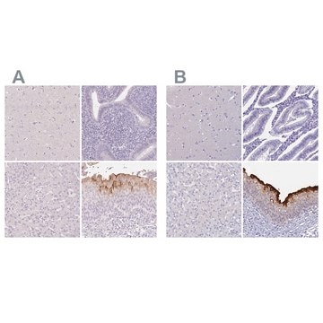 Anti-UPK2 antibody produced in rabbit Prestige Antibodies&#174; Powered by Atlas Antibodies, affinity isolated antibody, buffered aqueous glycerol solution