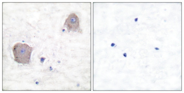 Anti-MGLUR4 antibody produced in rabbit affinity isolated antibody