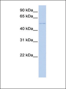 Anti-DCX (AB2) antibody produced in rabbit affinity isolated antibody