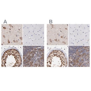 Anti-CCT2 antibody produced in rabbit Ab2, Prestige Antibodies&#174; Powered by Atlas Antibodies, affinity isolated antibody, buffered aqueous glycerol solution