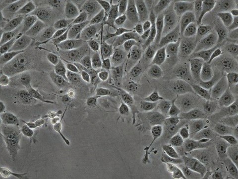 MOC2 Mouse Oral Squamous Cell Carcinoma (OSCC) Cell Line