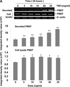 Anti-&#946;-Actin antibody, Mouse monoclonal clone AC-15, purified from hybridoma cell culture