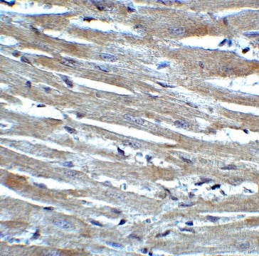 Anti-CX3CR1 antibody produced in rabbit affinity isolated antibody