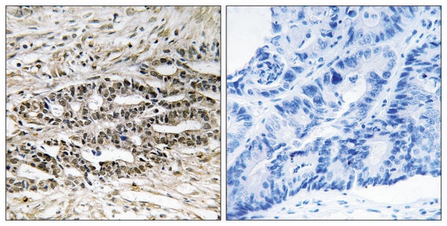 Anti-MDM4 antibody produced in rabbit affinity isolated antibody