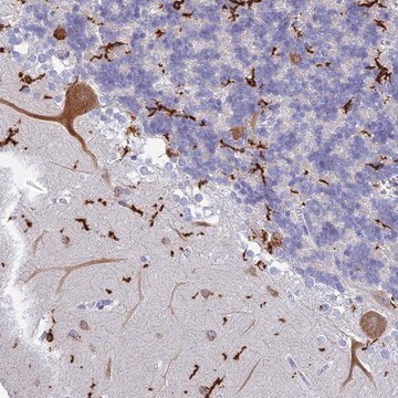 Anti-CEP152 antibody produced in rabbit Prestige Antibodies&#174; Powered by Atlas Antibodies, affinity isolated antibody, buffered aqueous glycerol solution