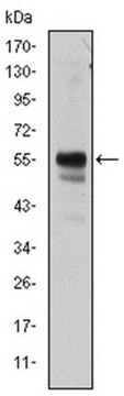 Anti-RUNX1 Antibody, clone 2B5 ascites fluid, clone 2B5, from mouse