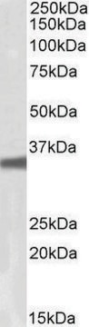 Anti-GNB3 antibody produced in goat affinity isolated antibody, buffered aqueous solution