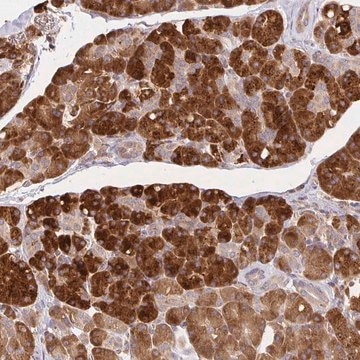 Anti-IRAK1 antibody produced in rabbit Prestige Antibodies&#174; Powered by Atlas Antibodies, affinity isolated antibody, buffered aqueous glycerol solution