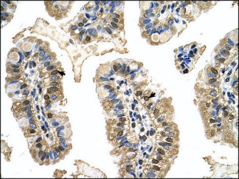 Anti-MCM8 antibody produced in rabbit affinity isolated antibody