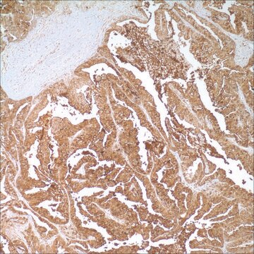 CEA (CEA31) Mouse Monoclonal Antibody