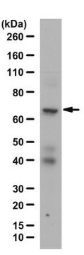 Anti-SLP76 Antibody from rabbit, purified by affinity chromatography