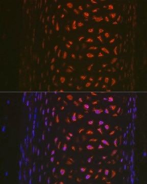 Anti- MMP13 antibody produced in rabbit