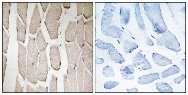 Anti-MARCH3 antibody produced in rabbit affinity isolated antibody