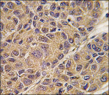 Anti-APOC3 (C-term) antibody produced in rabbit saturated ammonium sulfate (SAS) precipitated, buffered aqueous solution