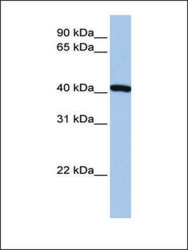 Anti-FTSJ1 antibody produced in rabbit affinity isolated antibody