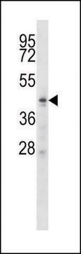 ANTI-ZDHHC6 (C-TERM) antibody produced in rabbit IgG fraction of antiserum, buffered aqueous solution