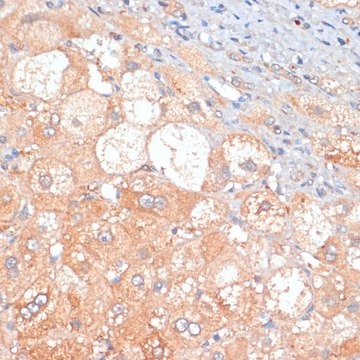 Anti-RIP3 antibody produced in rabbit