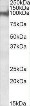 Anti-PKP2 antibody produced in goat affinity isolated antibody, buffered aqueous solution