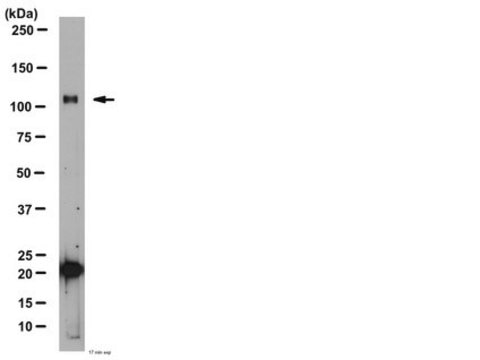 Anti-Glutamate Receptor Delta 1/2 Antibody from rabbit, purified by affinity chromatography