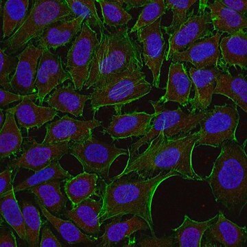 Anti-Dynein Antibody, IC, cytosolic, clone 74.1, Alexa Fluor&#8482; 555 conjugate clone 74.1, from mouse, ALEXA FLUOR&#8482; 555