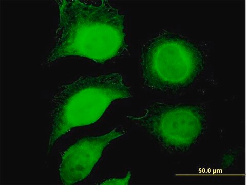 Anti-GAPDH antibody produced in mouse purified immunoglobulin, buffered aqueous solution