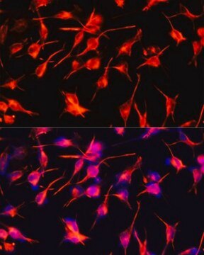 Anti-GFAP antibody produced in rabbit