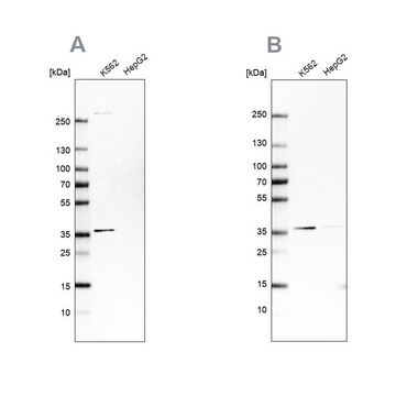 Anti-OTUD6B antibody produced in rabbit Prestige Antibodies&#174; Powered by Atlas Antibodies, affinity isolated antibody, buffered aqueous glycerol solution