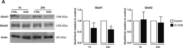 Anti-Glutamate receptor 1 Antibody from rabbit, purified by affinity chromatography