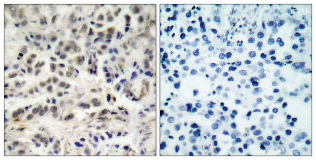 Anti-p27 KIP1 antibody produced in rabbit affinity isolated antibody