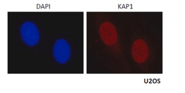 Anti-KAP-1/TRIM28 Antibody serum, from rabbit