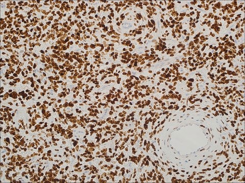 STAT6 (EP325) Rabbit Monoclonal Primary Antibody