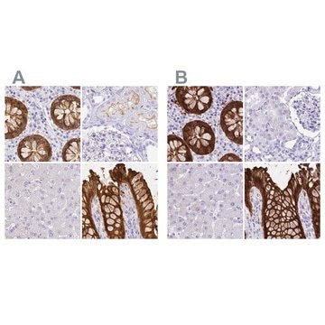 Anti-LGALS4 antibody produced in rabbit Prestige Antibodies&#174; Powered by Atlas Antibodies, affinity isolated antibody, buffered aqueous glycerol solution