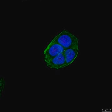 Anti-NuMA1 Antibody, clone AD6-1 clone AD6-1, from mouse