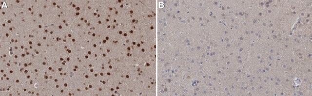 Anti-Tbr2 Antibody from chicken, purified by affinity chromatography