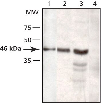 Anti-TSG101 antibody produced in rabbit ~2&#160;mg/mL, affinity isolated antibody, buffered aqueous solution