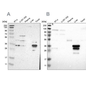 Anti-PHYH antibody produced in rabbit Prestige Antibodies&#174; Powered by Atlas Antibodies, affinity isolated antibody, buffered aqueous glycerol solution