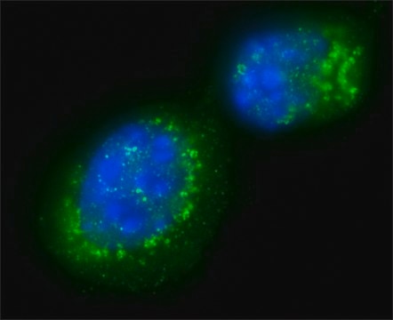 Anti-Sir2 (AS-16) antibody produced in rabbit affinity isolated antibody, buffered aqueous solution