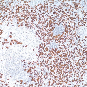 Cytokeratin (35betaH11) Mouse Monoclonal Antibody