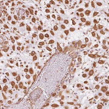 Anti-FOXR2 antibody produced in rabbit Prestige Antibodies&#174; Powered by Atlas Antibodies, affinity isolated antibody