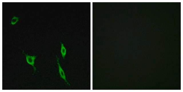 Anti-DCC antibody produced in rabbit affinity isolated antibody