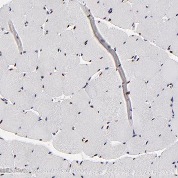 Anti-OGFOD1 antibody produced in rabbit Prestige Antibodies&#174; Powered by Atlas Antibodies, affinity isolated antibody, buffered aqueous glycerol solution